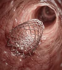 Smart Materials